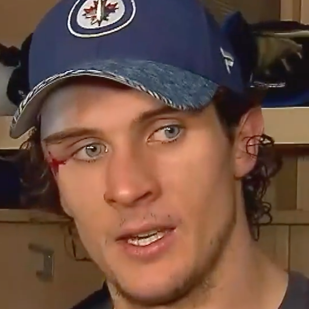 NHL Player Returns To Playoff Game After 75+ Stitches In Face